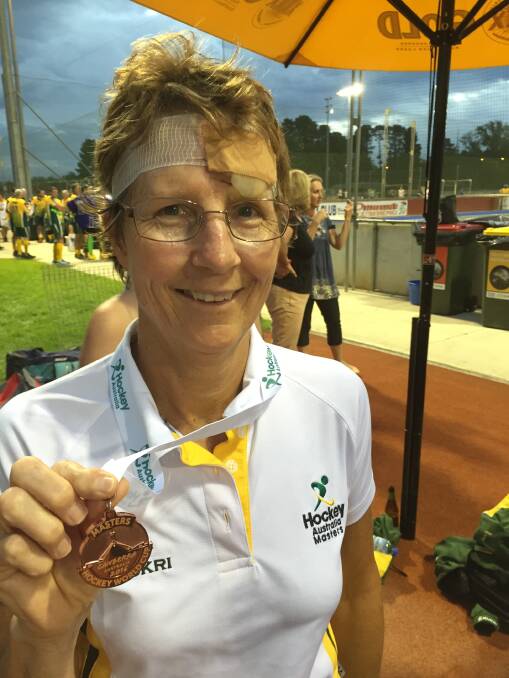BATTERED BUT HAPPY: Cheryl Rutherford proudly wears the scars
of success.