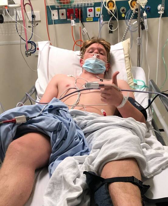 IN HOSPITAL ALONE: 17-year-old Josh Elbourne is about to have major surgery after dislocating his ankle and breaking his lower leg playing rugby for his Brisbane boarding school on Saturday, however his Moree parents are unable get to Queensland to be with him. Photo: supplied